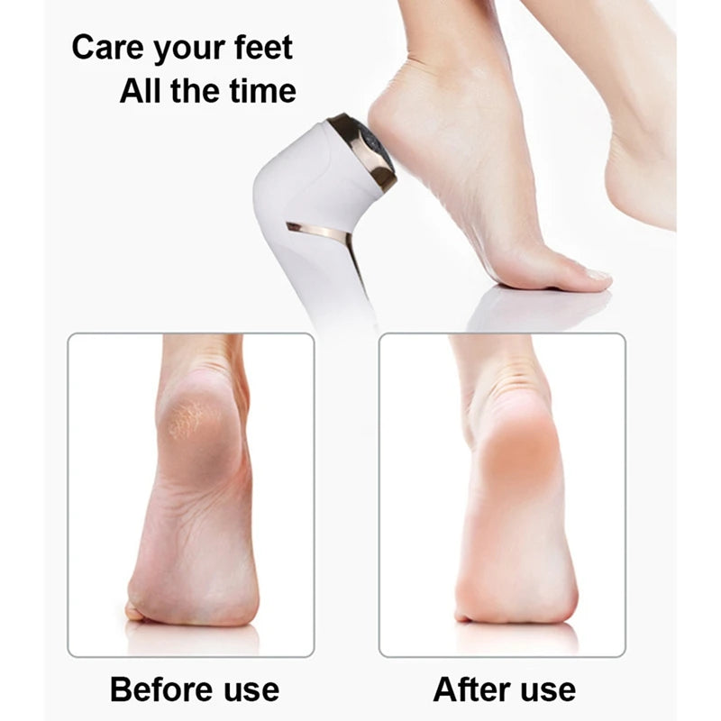 Callus Remover For Feet Portable Pedicure Kit Waterproof